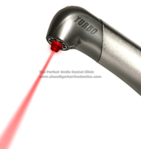 Laser Treatment in Chandigarh